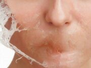 Cildine bunu yapanlar yandı! Cildiniz yanabilir…